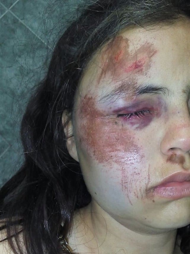 Carhué: su ex la golpeó y la dejó inconsciente
