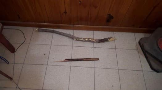 Le cortaron la yugular: está grave