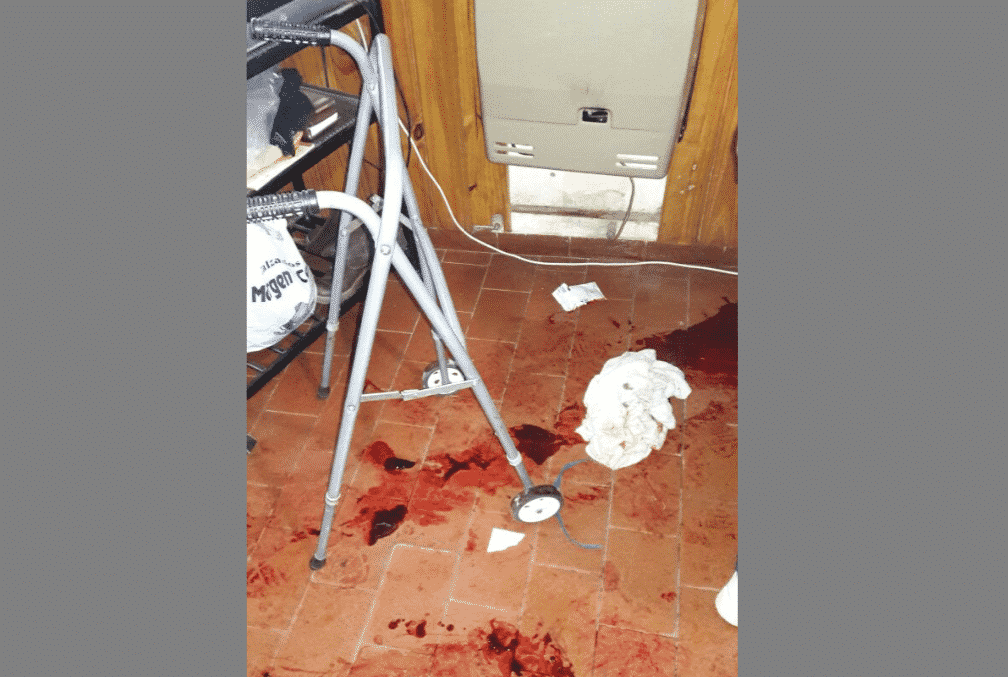 Detuvieron a un mecánico que quiso matar a golpes a una abuela de 86 años