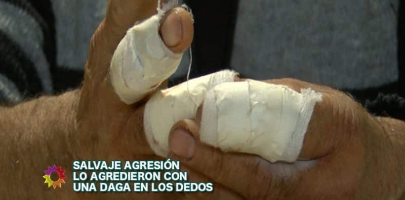 Salvaje agresión
