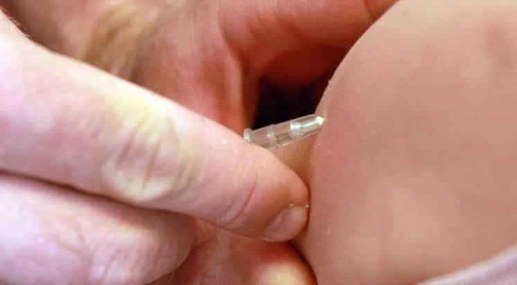 Sarampión: alerta por el primer caso autóctono en el país