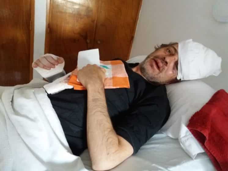 Dorrego: lo golpearon brutalmente para robarle $15.000