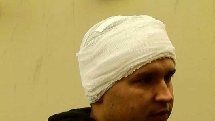 Volvieron a operar al joven agredido por un rugbier en Monte Hermoso