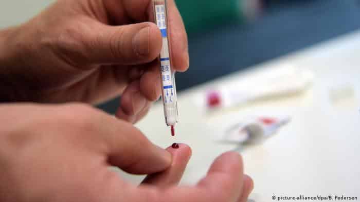 Se realizará una jornada de testeo de VIH y ETS
