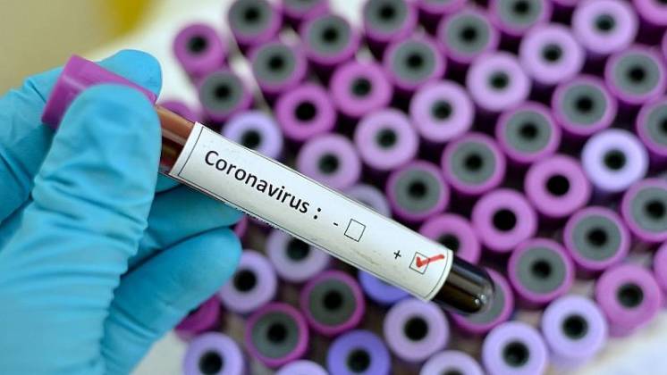 El fundador de Moderna aseguró que el coronavirus “salió por accidente de un laboratorio de Wuhan”