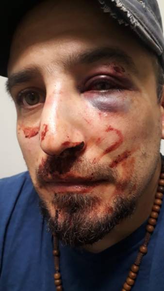 abuso policial