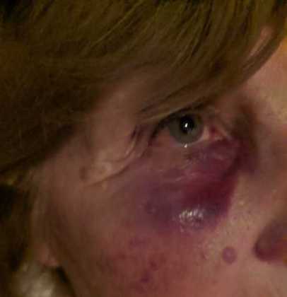 Brutal paliza a una mujer de 73 años para robarle
