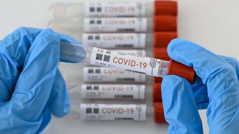 106 casos nuevos casos de coronavirus