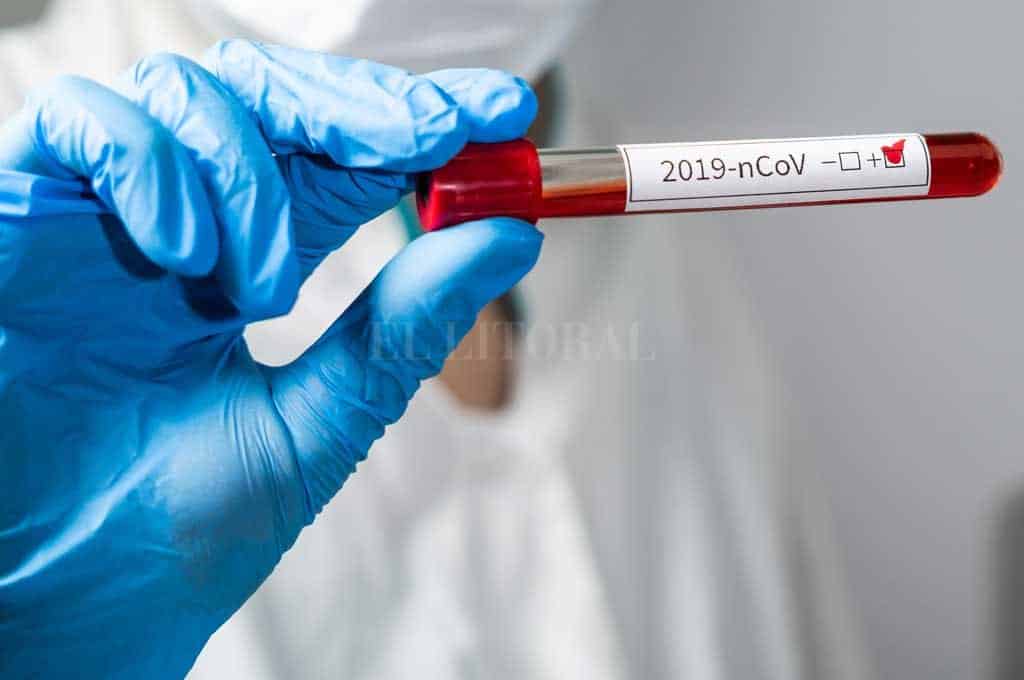 Punta Alta: 4 fallecidos y 35 casos nuevos de coronavirus