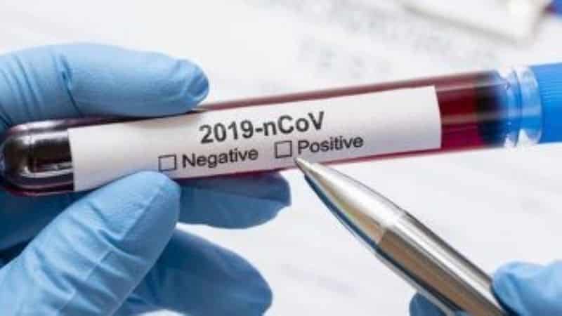 Bahía Blanca: 128 casos nuevos de coronavirus y 3 muertes