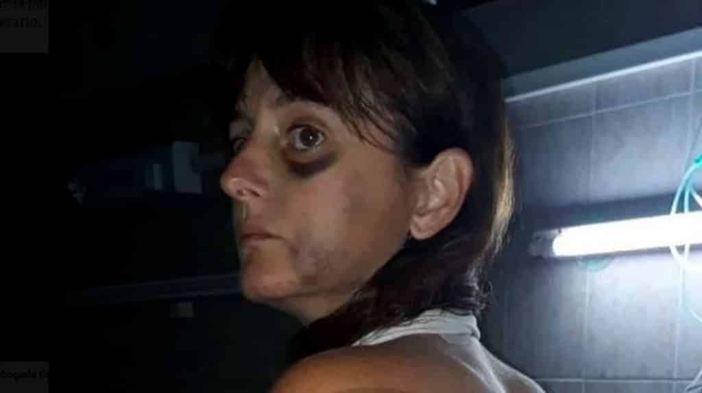 Su novia lo dejó, la golpeó brutalmente pero la Justicia le dio una segunda oportunidad