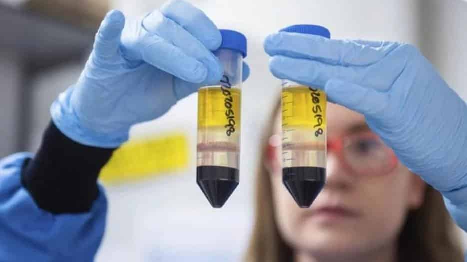 Vacuna contra el coronavirus | La Anmat aprobó las dosis de AstraZeneca y la Universidad de Oxford
