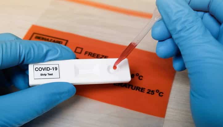 Cómo es el test rápido para detectar coronavirus que ya se vende en farmacias