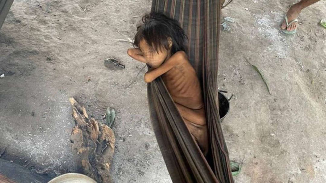 La impactante foto de una nena que muestra el abandono de los indígenas yanomami en Brasil: tiene ocho años y pesa solo 12 kilos