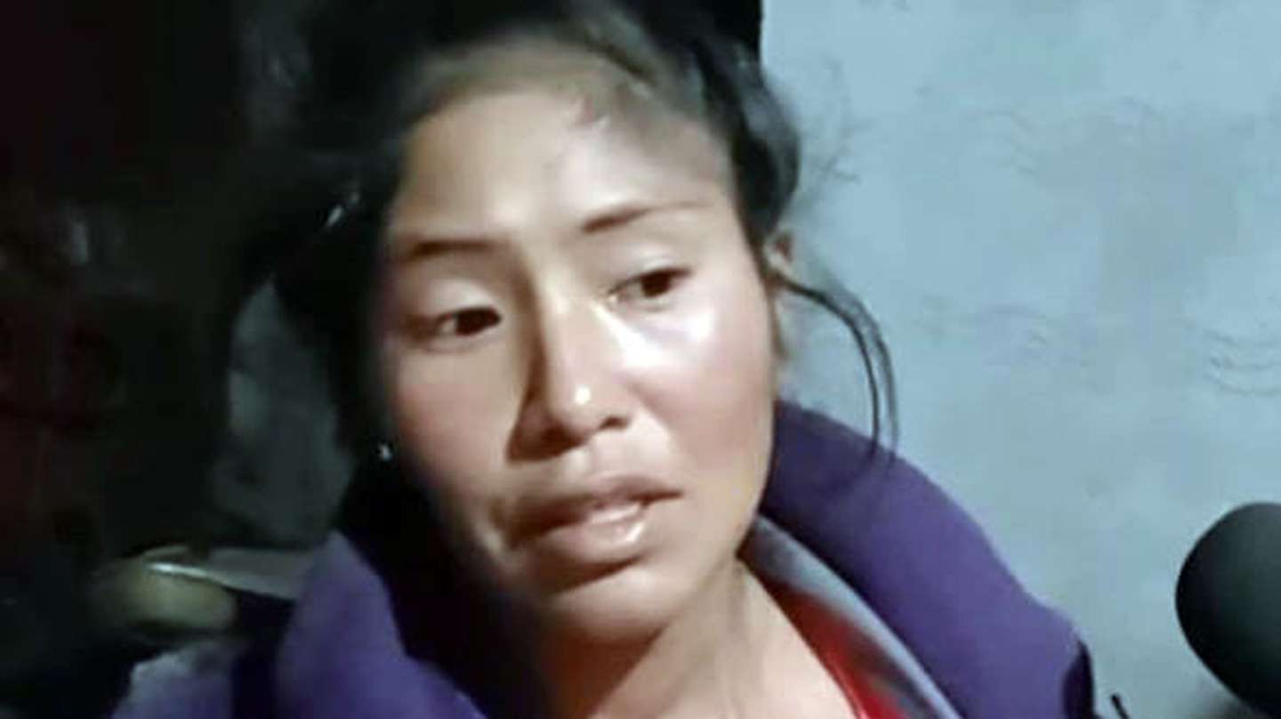 Salvaje ataque a una mujer en Salta: la torturaron con mordidas de perros y la obligaron a tomar orina