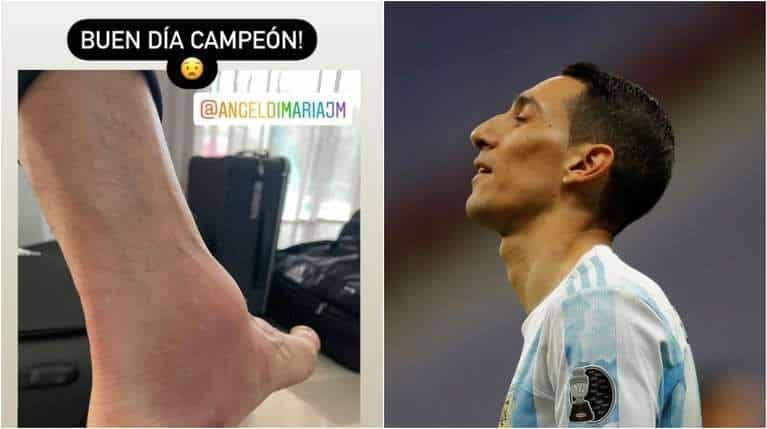 Así le quedó el tobillo a Di María después de la final ante Brasil: el detalle de la foto que publicó en las redes
