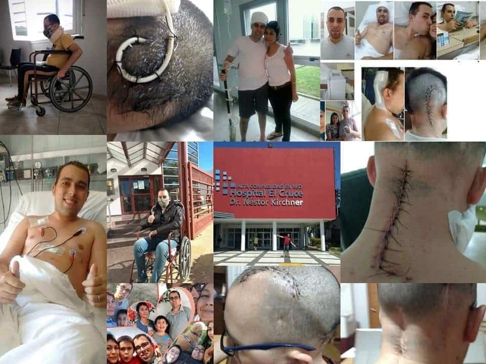 Pasó por 12 operaciones por un tumor, la obra social no le cubre algunas terapias de la rehabilitación y ofrece un bono para juntar el dinero