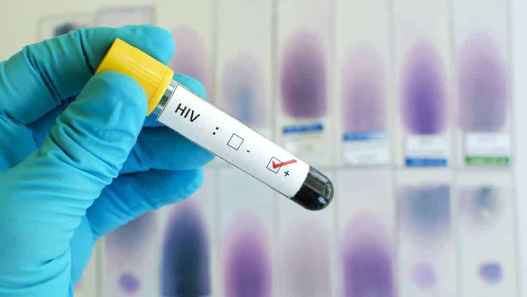 Impulsan la detección del VIH con pruebas rápidas, confiables y discretas en Argentina