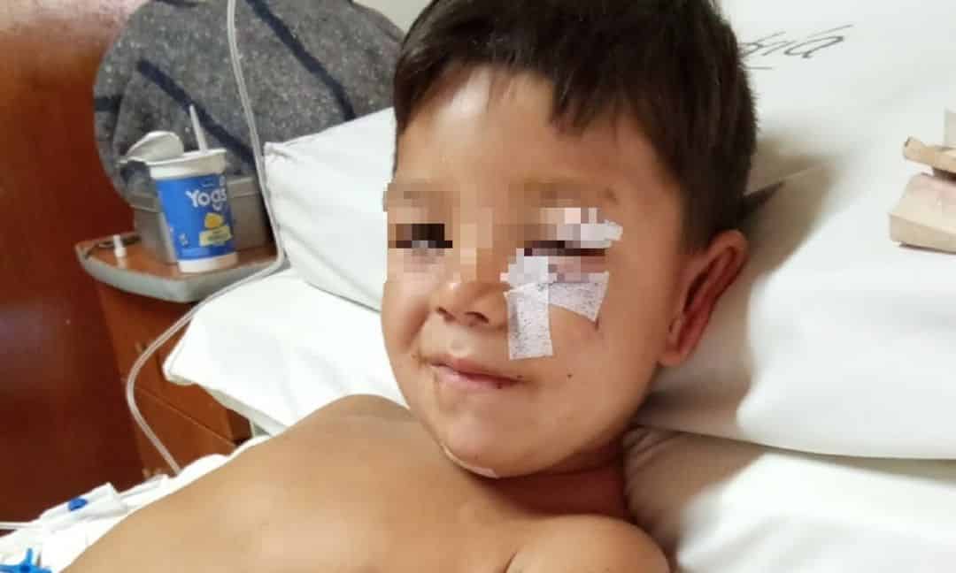 Dieron de alta al pequeño mordido por un dogo en Arroyo Pareja
