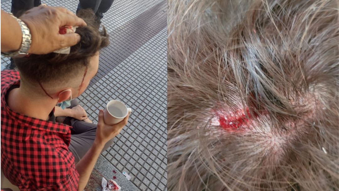 Pleno centro: tiraron un pedazo de metal, le cayó directo en la cabeza y le provocó una herida