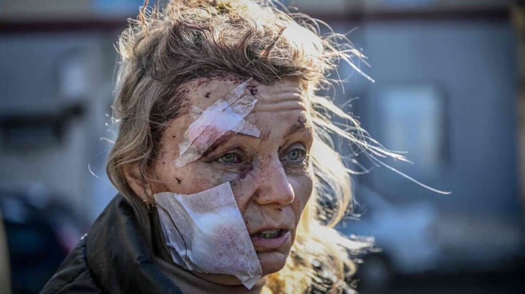 Las fotos del ataque ruso en Ucrania: pánico, destrucción y muerte en las calles