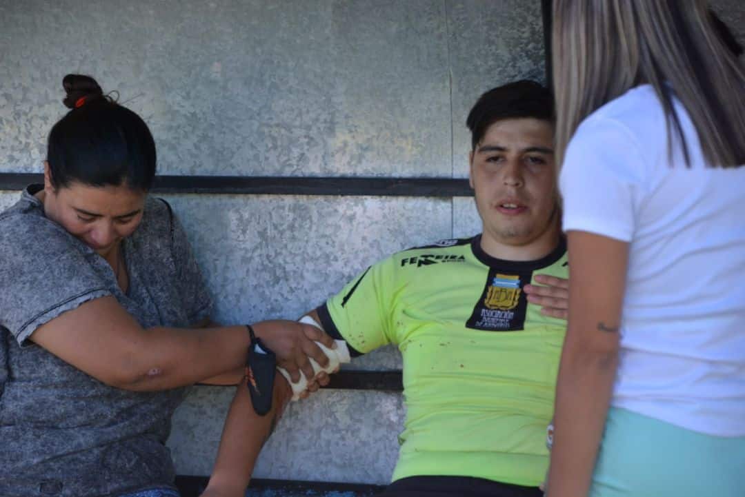 Árbitro herido por una bengala: “Yo creo que fue un accidente”