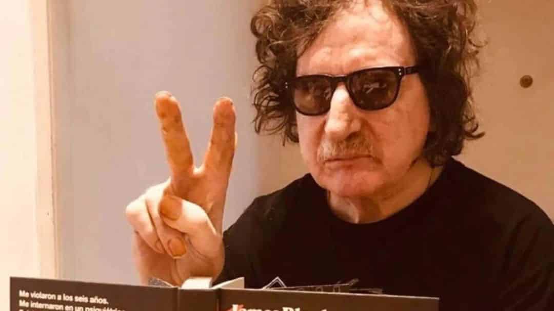 Charly García fue dado de alta después de estar más de un mes internado