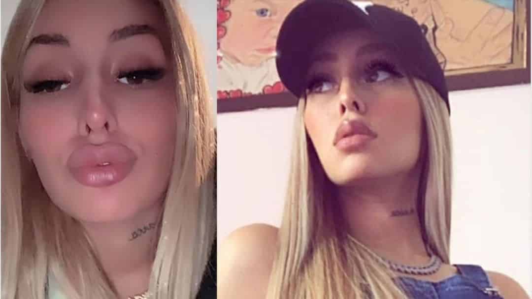 Tamara Báez lució encantada su nueva boca: “Amo que sea como la del filtro”