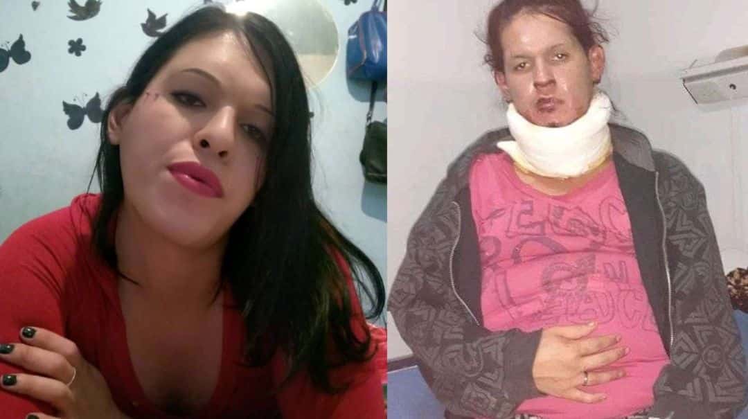 “Esto no se lo deseo a nadie”: el calvario de una mujer trans quemada por un hombre en Córdoba