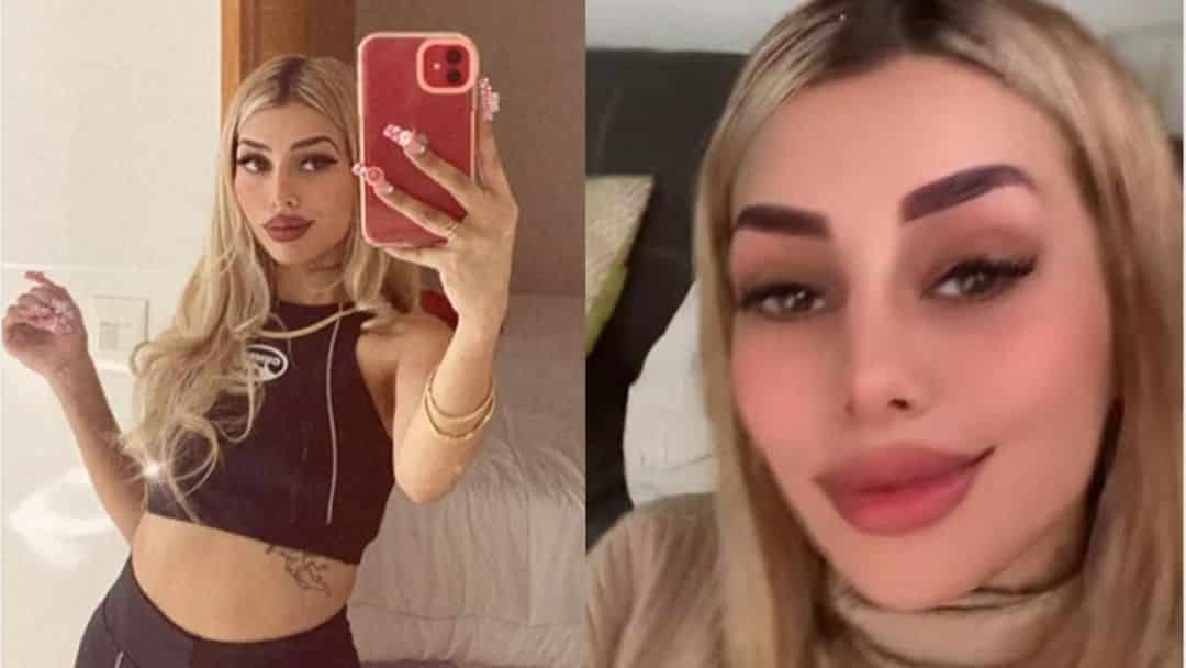 Tamara Báez, la pareja de L-Gante, mostró su nuevo retoque estético: “Me animé”