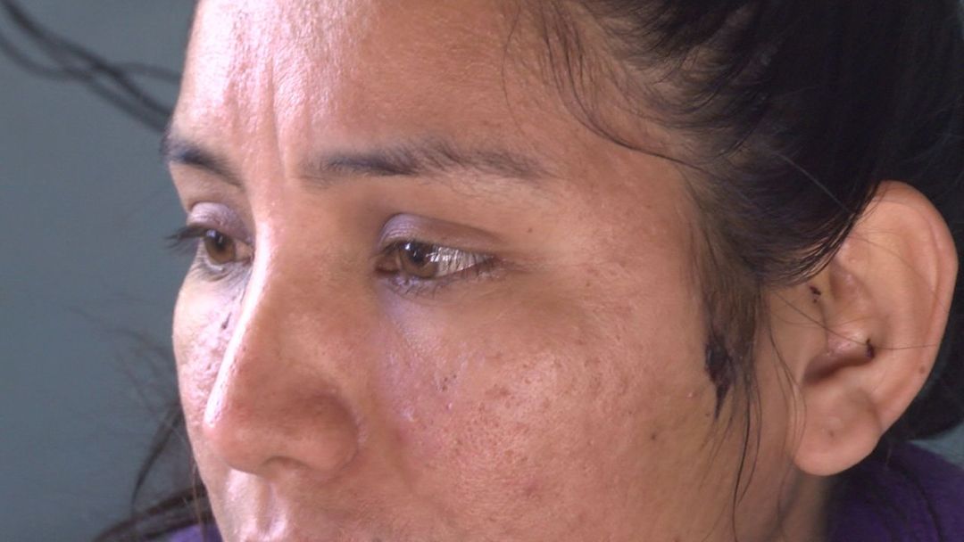 Fue golpeada por su expareja y ahora teme por su vida