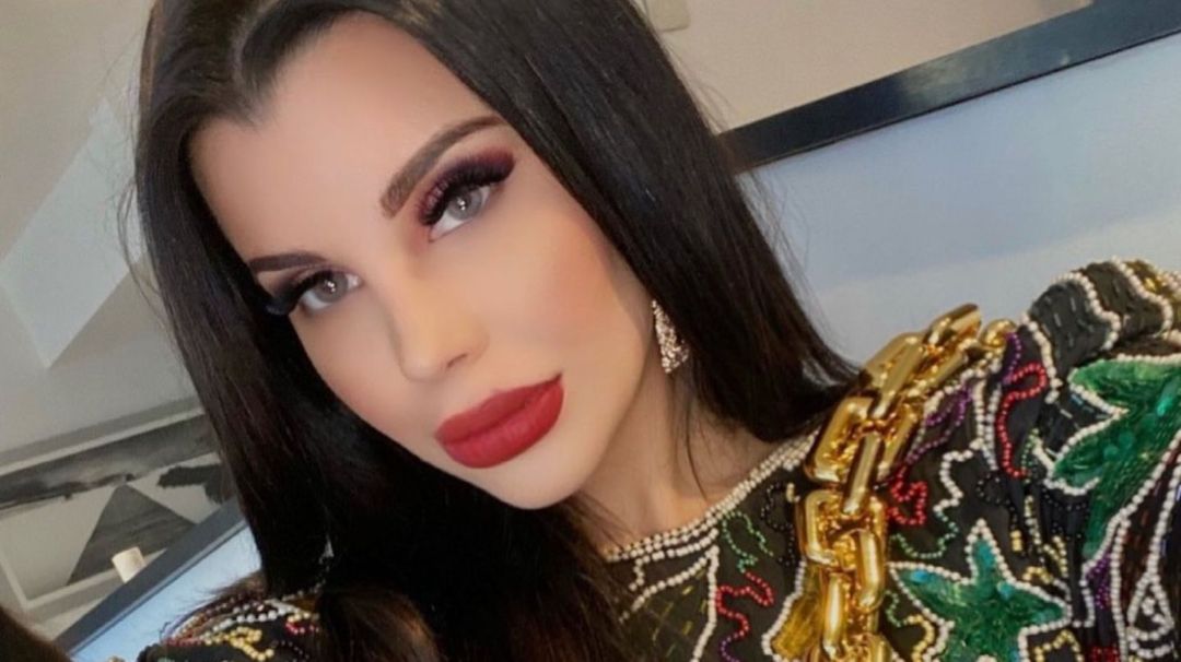 Charlotte Caniggia se hizo una cirugía estética y mostró una foto que generó críticas: “¡Tenés mucha sangre!”