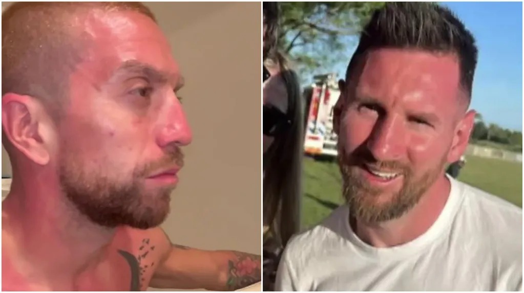 Los jugadores de la Selección terminaron quemados por el sol tras los festejos: “Necesito aloe vera”
