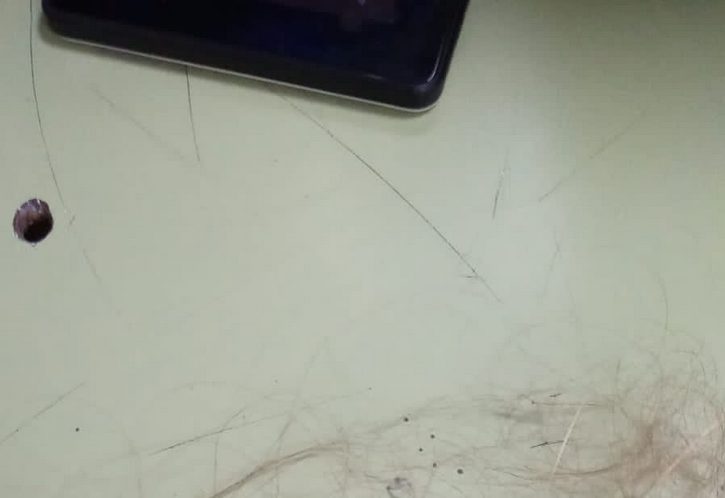 Golpean a una alumna y publican el mechón de pelo que le arrancaron a la víctima