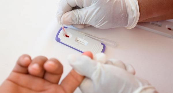La UNS realizará una jornada de testeo de VIH y Sífilis este viernes