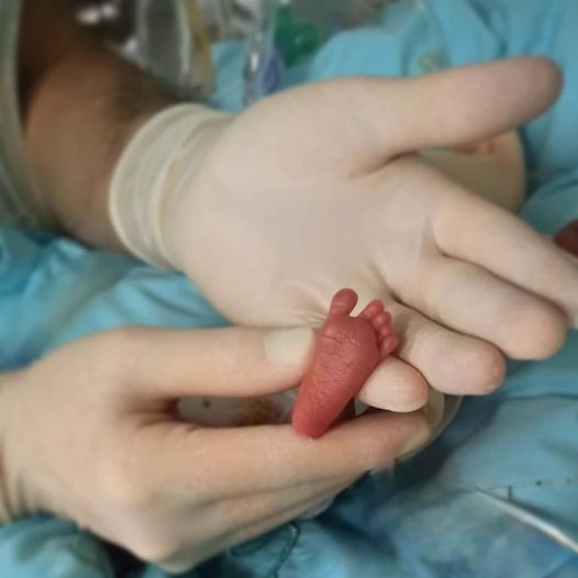 “Pequeños grandes héroes”: la foto de un bebé prematuro que publicó un médico y conmovió a todos