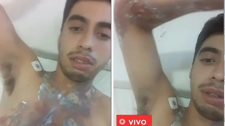 Habló el joven que fue alcanzado por un rayo en San Luis y sufrió quemaduras en el 20% del cuerpo