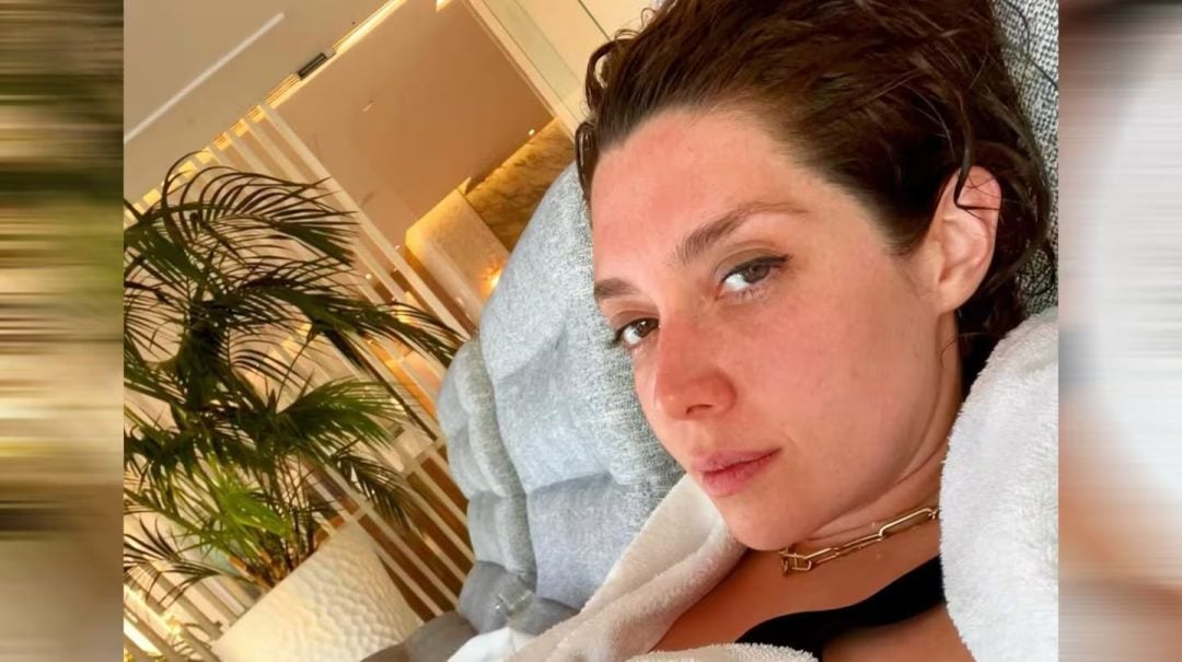Militta Bora habló por primera vez de su problema de salud y generó preocupación: “Es grave e irreversible”