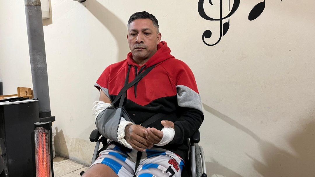“No hay denuncia, no hay pruebas, pero me golpearon igual”: un hombre fue brutalmente agredido tras una falsa acusación de acoso
