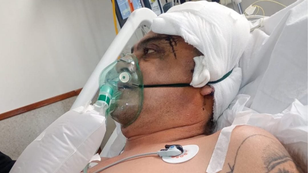 “Un malviviente vino a quitarle la vida a mi hermano”: brutal ataque que lo dejó al borde de la muerte