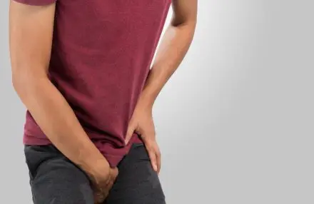 varicocele