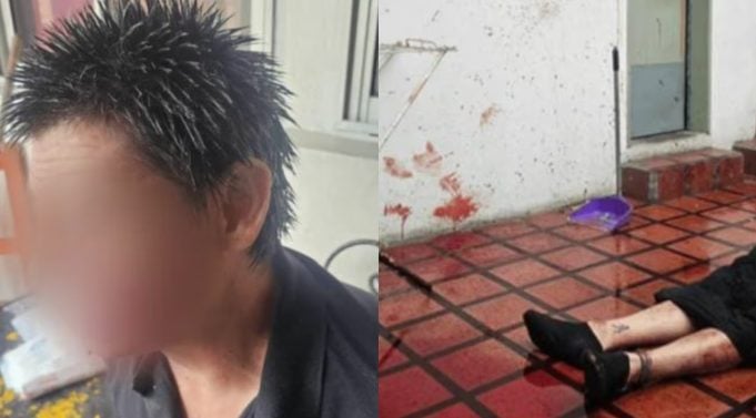 Violenta pelea a cuchillazos en una pensión de La Plata: dos hombres terminaron desfigurados