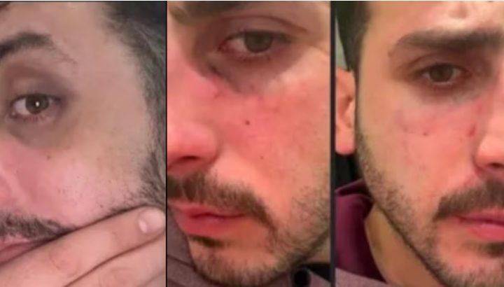 “¿Otra vez te pegó?”: revelaron chats y fotos sobre las presuntas agresiones que habría sufrido el joven asesinado en Chaco